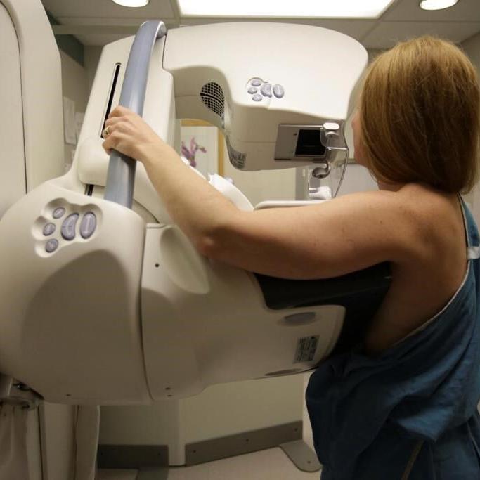 Ontario lowers mammogram self-referral age to 40 from 50, bookings can now be made
